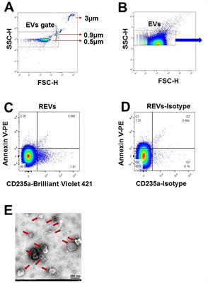 Circulating extracellular vesicles as novel biomarkers for pulmonary arterial hypertension in patients with systemic lupus erythematosus